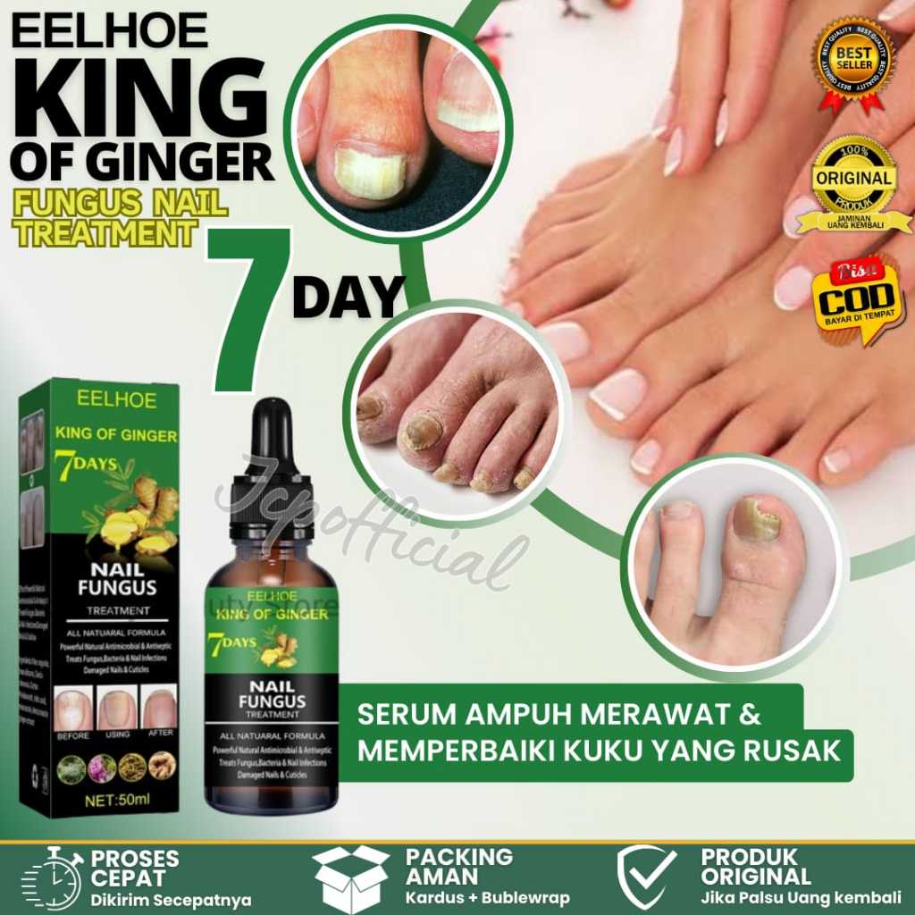 EELHOE King Of Ginger 7 Days Nail Fungus Treatment 50ml Nail Repair Lotion Repair Gray Nails Bright 