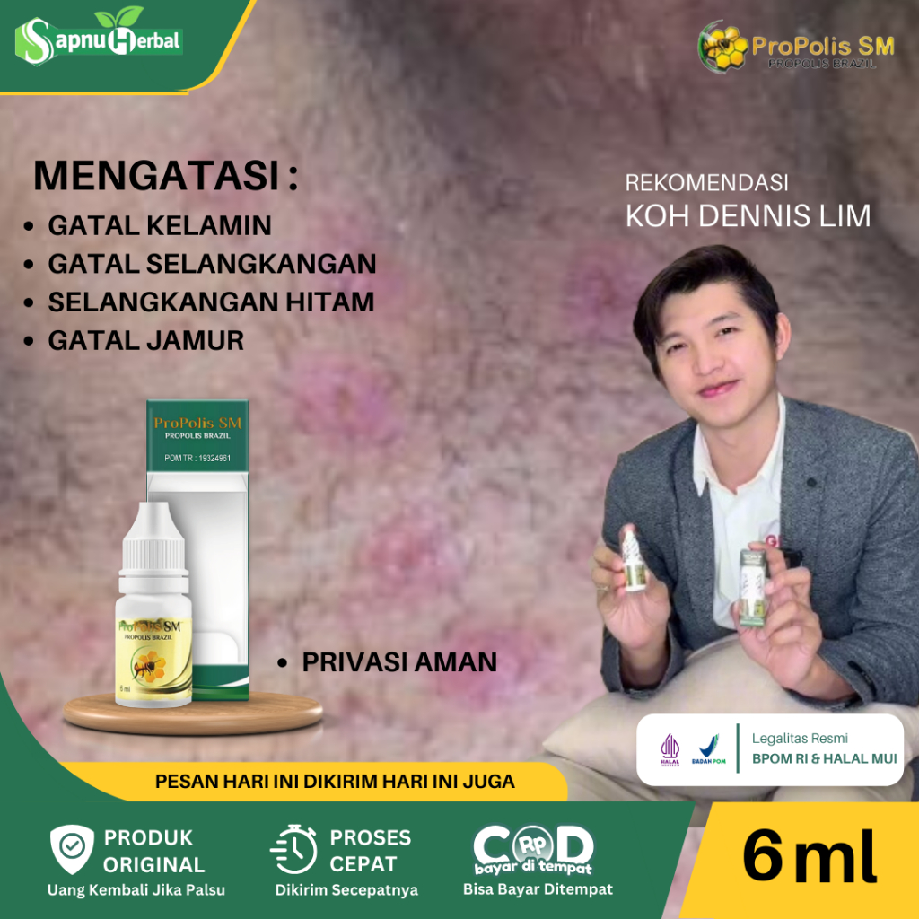 Obat Gatal Selangkangan, Obat Selangkangan Lecet Berjamur, Obat Selangkangan Hitam dan Gatal, Obat G