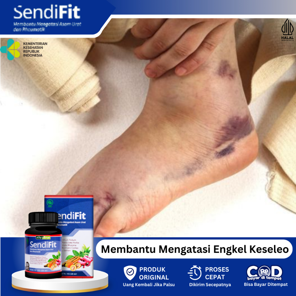 Obat Kaki Keseleo Dan Bengkak, Obat Pergelangan Kaki Terkilir, Obat Kaki Bengkak Akibat Keseleo, Oba