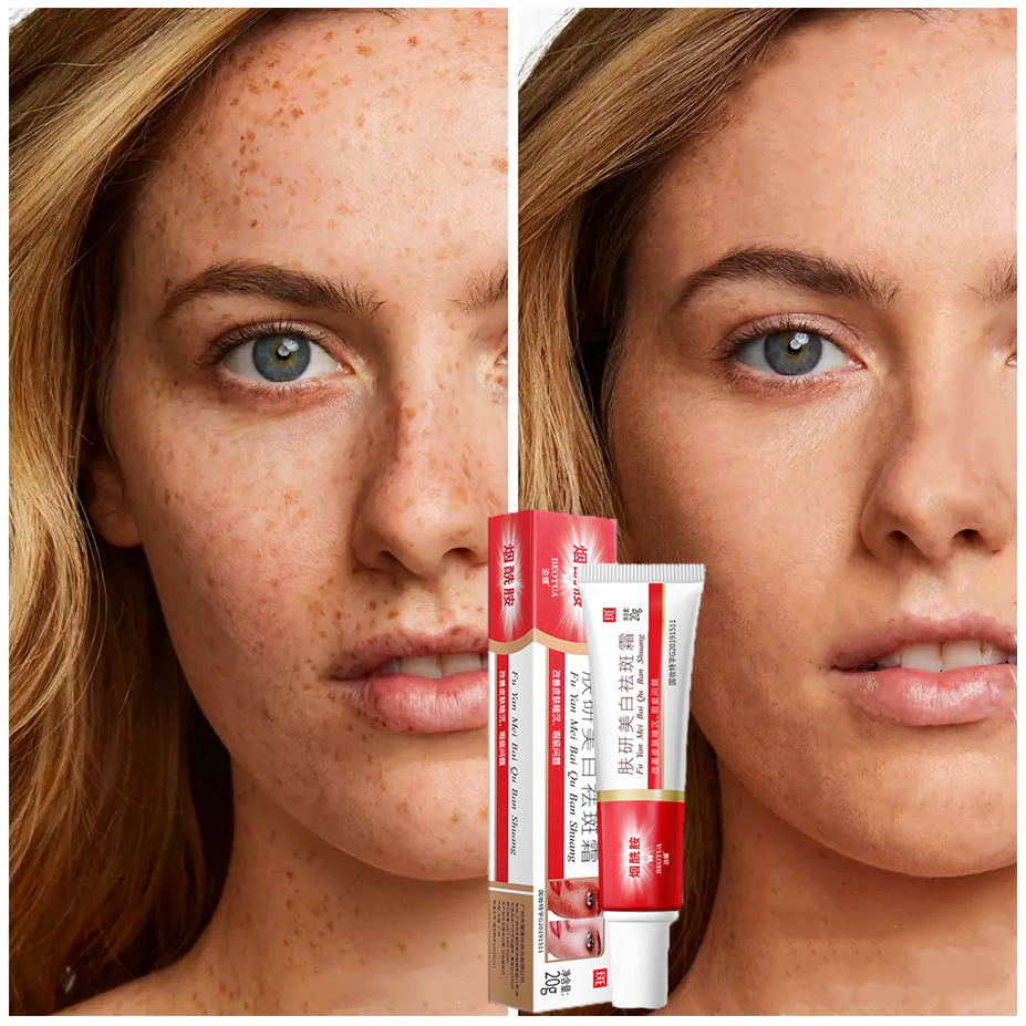 Niacinamide Cream Penghilang Flek Hitam  Original Cream Penghilang Flek Hitam Cream 100% Original Sa