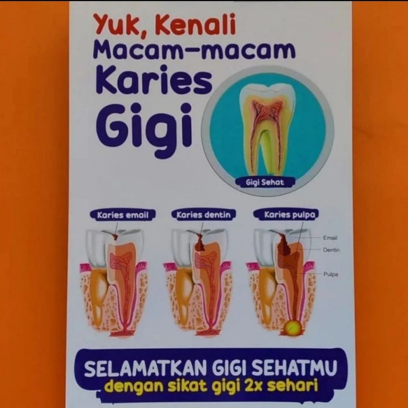 Poster karies gigi baha ivory 230 gram I Poster kedokteran gigi I gambar karies gigi