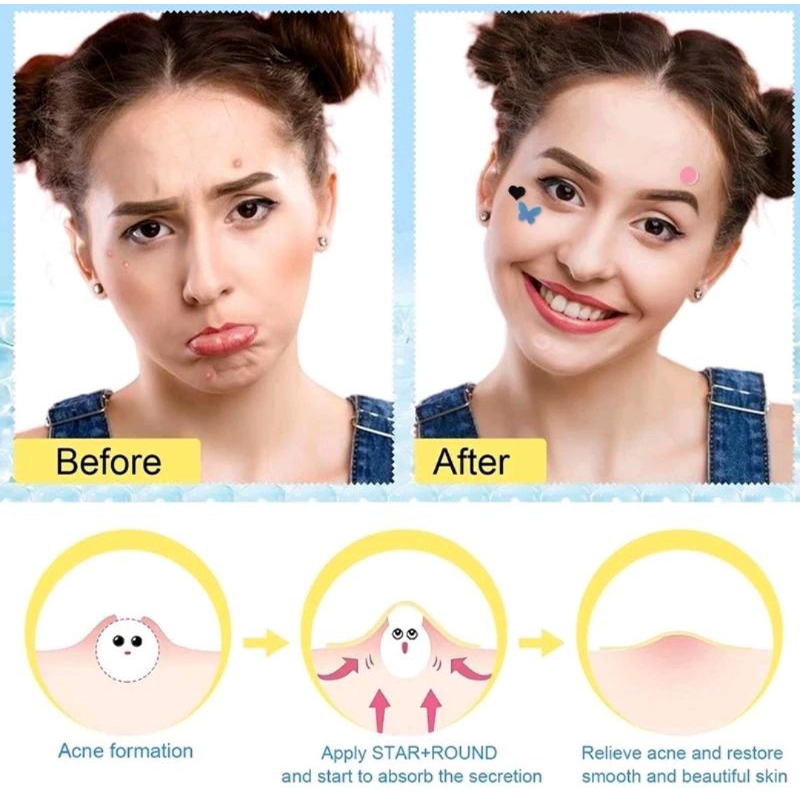 Acne Patch Tempelan Jerawat Bintang hydrocolloid Acne Plester Jerawat