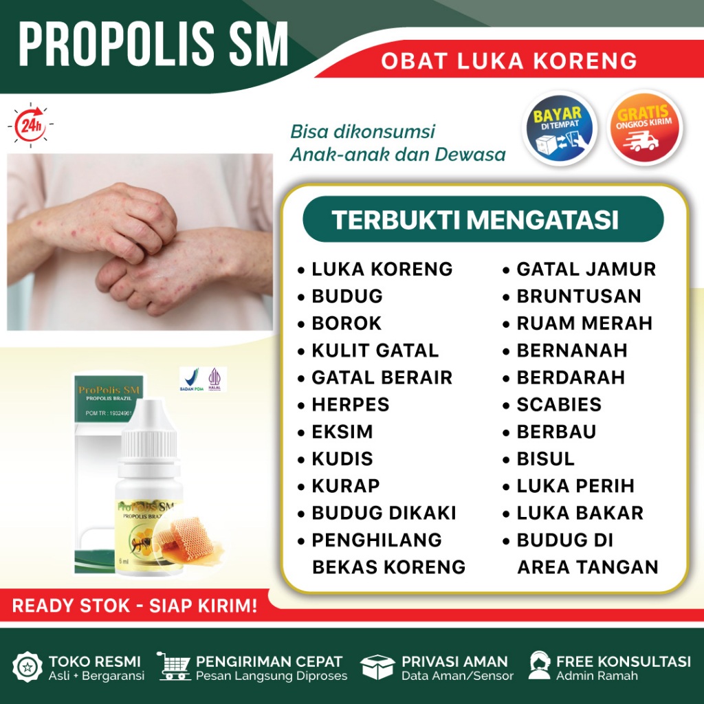 Obat Luka Bekas Koreng, Obat Herbal Luka Koreng, Obat Penghilang Koreng di Kaki Propolis SM