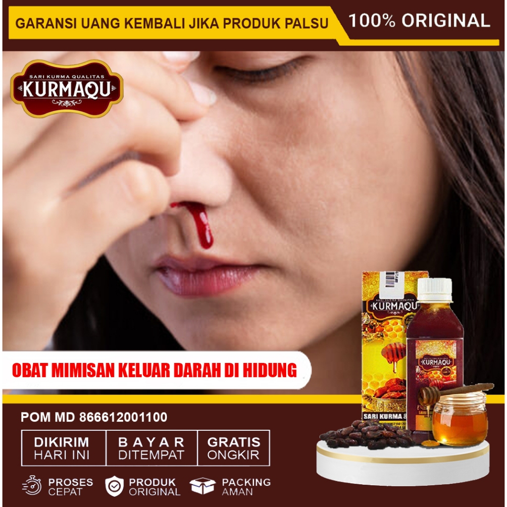 Obat Sering Mimisan Anak, Mimisan Sinusitis Polip Kronis Akut Hidung Berdarah Herbal Kurmaqu Asli Or