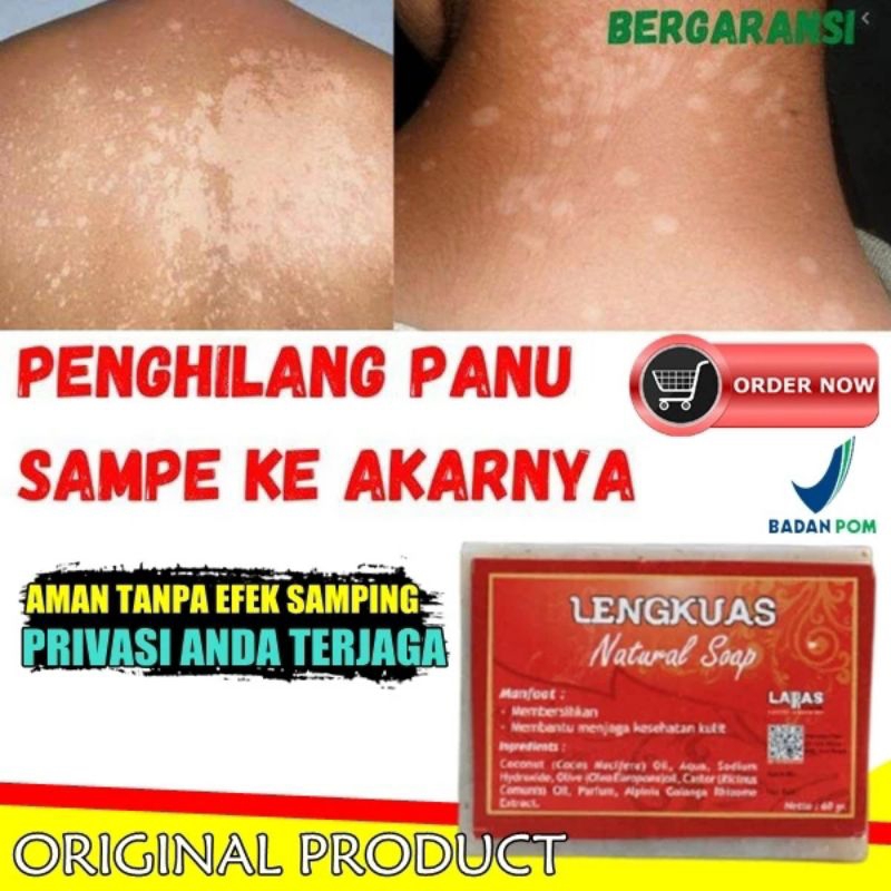 SABUN LENGKUAS/SABUN PANU/SABUN ANTI GATAL