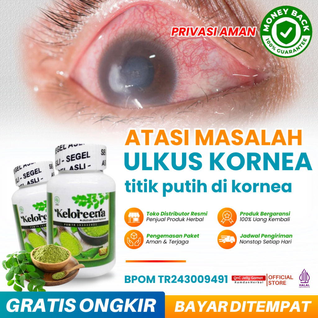 Obat Ulkus Kornea Titik Putih di Kornea Mata Nyeri Sakit Bintik Putih di Tengah Mata Kornea Mata Inf