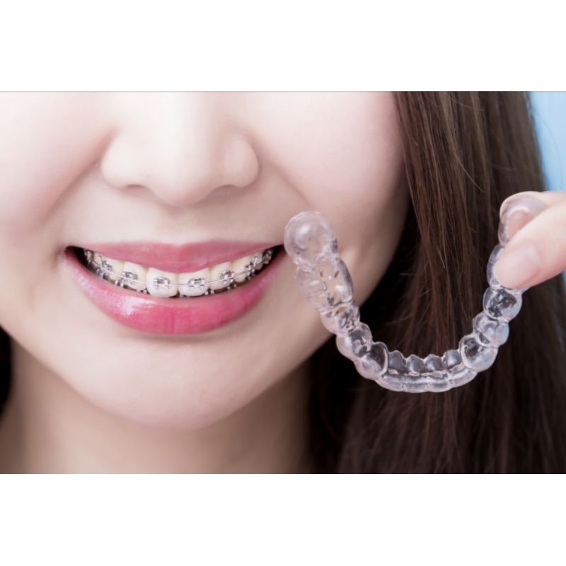 Retainer Gigi(Transparan)