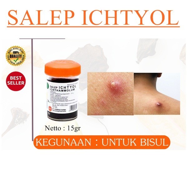 Salep ichtyol obat bisul bernanah penghilang rasa nyeri bisul hitam original asli AMPUH