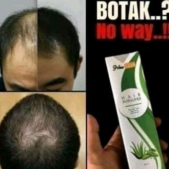 Hair Tonic Penumbuh Rambut Botak