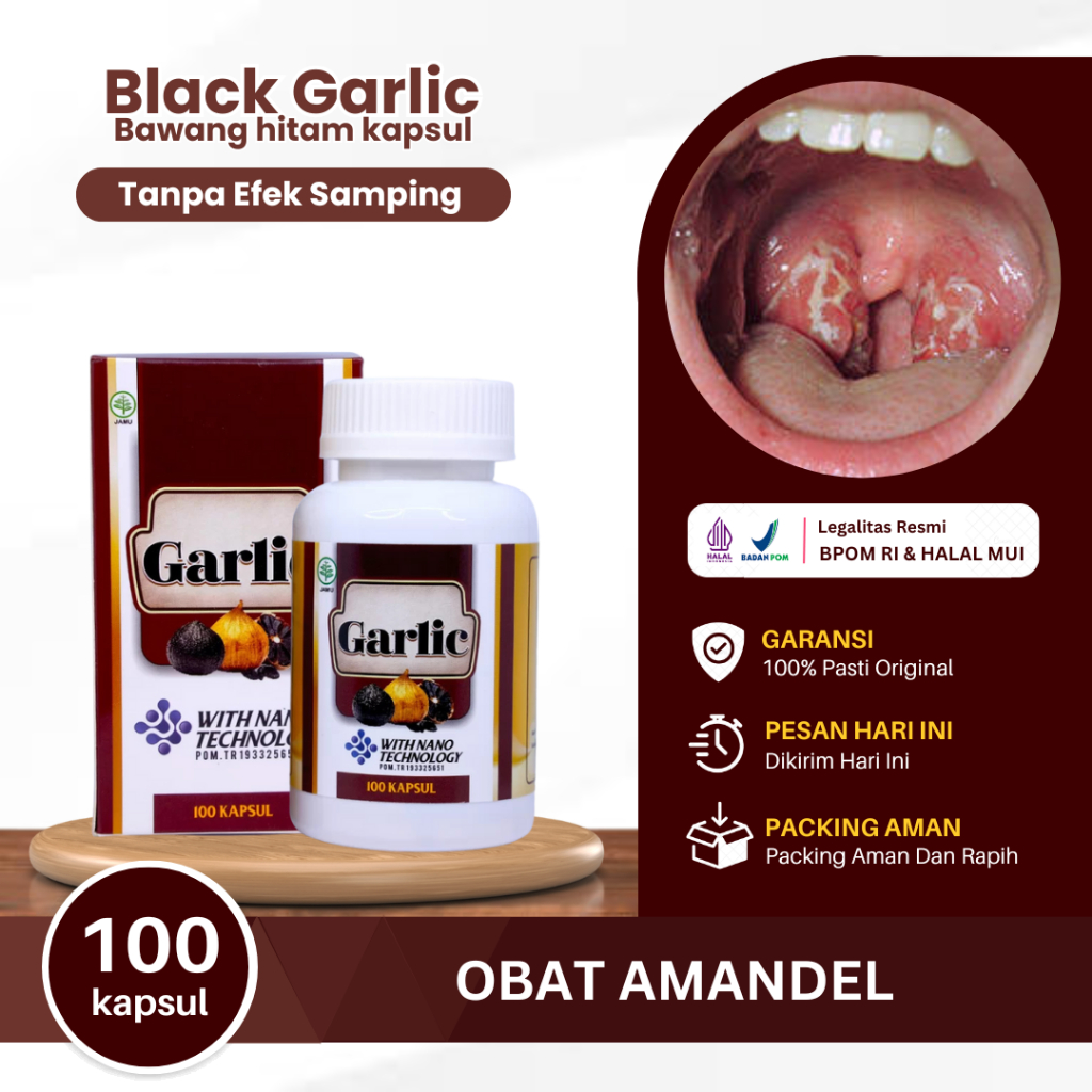 Obat Amandel, Radang Amandel, Amandel Bengkak, Sakit Amandel, Penghancur Amandel Tanpa Operasi, Aman