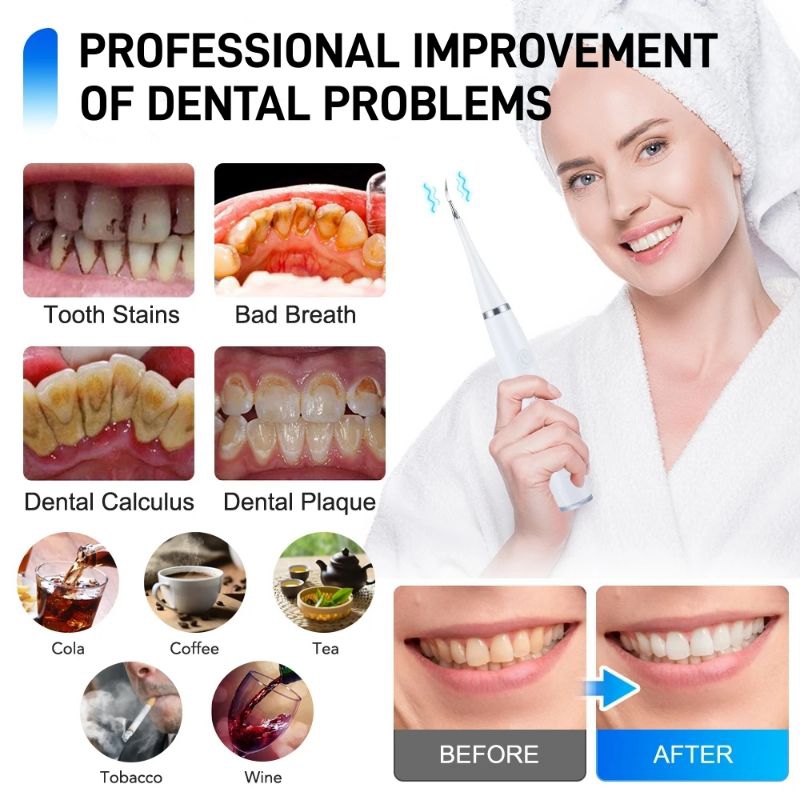 Smart UltraSonic Scaling Pembersih Gigi Penghilang Karang Gigi Elektrik Waterproof