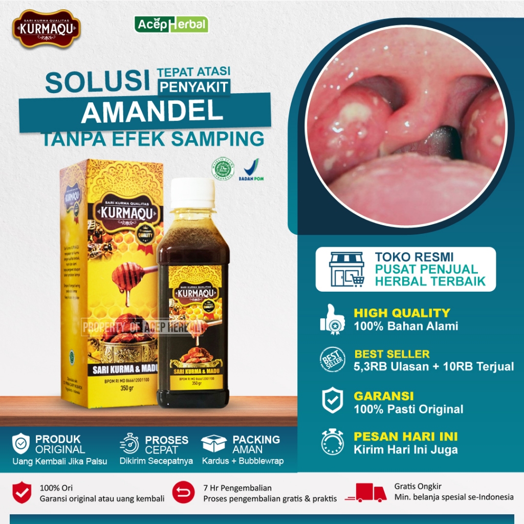 Obat Herbal Khusus Amandel Anak dan Dewasa, Susah Nelan, Sakit Menelan, Radang Tenggorokan, Bau Mulut, Batuk, Gondokan, Asma, Sesak Nafas, Tonsil Akut Dan Kronis, Papiloma, Graves, Kista, Lipoma, Tumor, Panas Dalam - KURMAQU 100% MADU ASLI PLUS KURMA-1