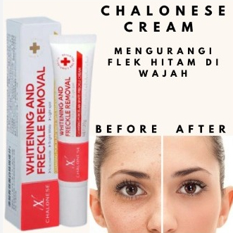 Chalonese Whitening And Freckle Removal Cream Wajah - Mencerahkan & Penghilang Flek Hitam