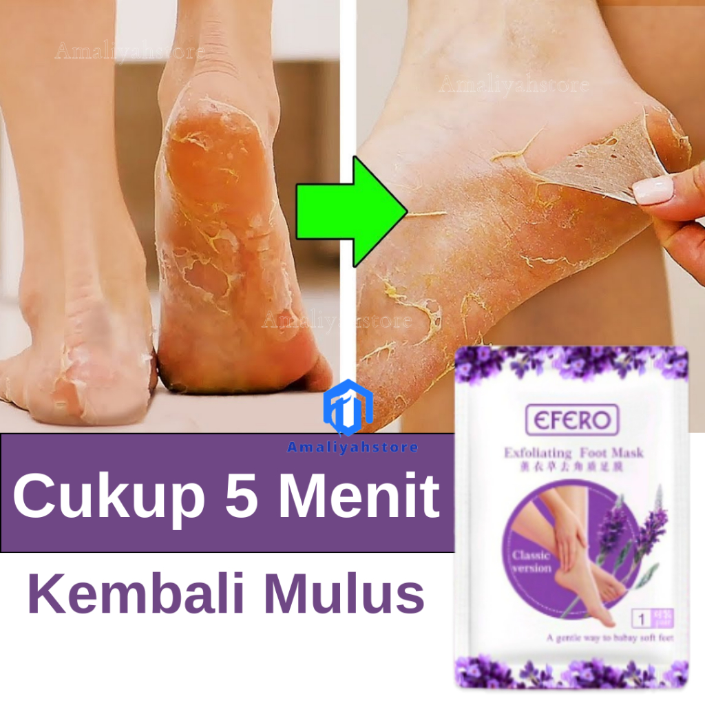 Masker Kaki Efero Foot Mask Obat Pengelupas Kulit Mati Penghalus Tumit Kaki Rayapan Pecah Dan Kering