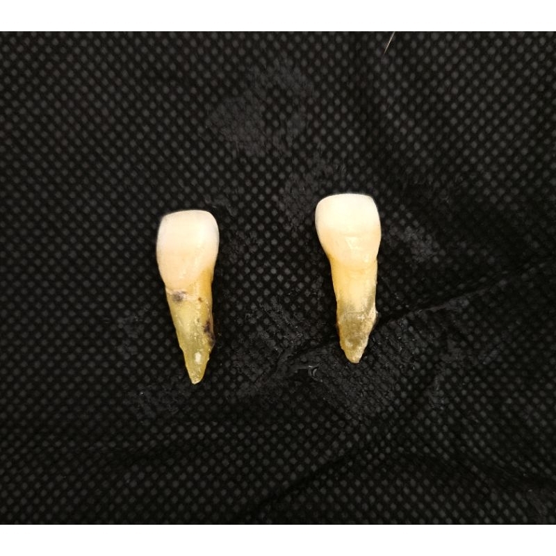 Gigi / unsur untyk praktikum kedokteran gigi, unsur molar, insisivus RA/Rb