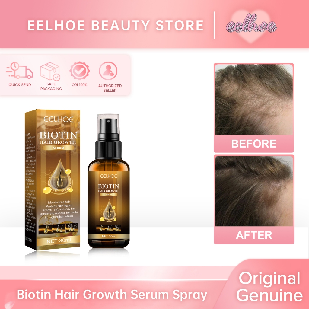 EELHOE Biotin Hair Growth Serum Spray - Penumbuh Rambut Paling Ampuh Mencegah Rambut Rontok