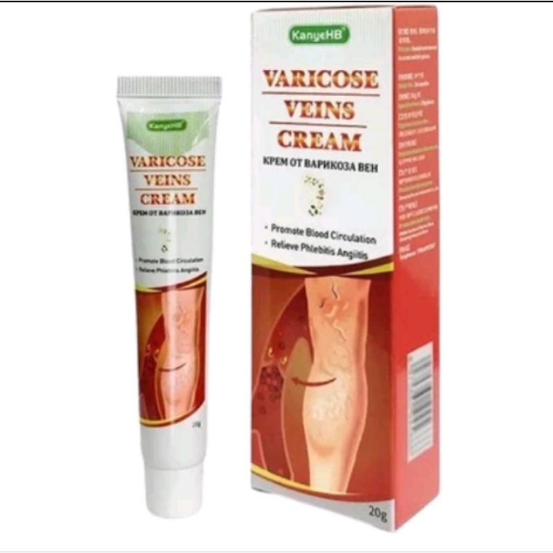 Varicose Veins Cream obat varises