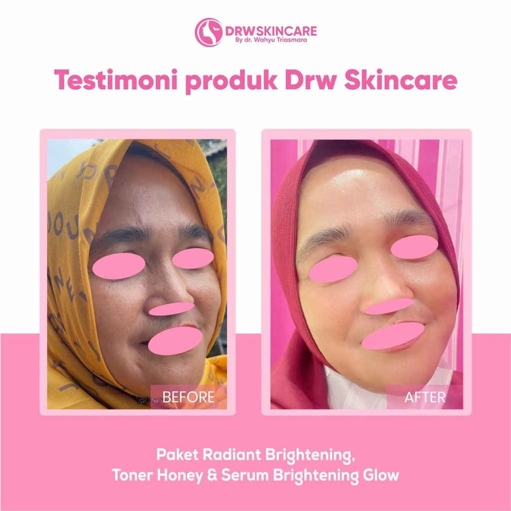 Drw Skincare Testimoni Paket Radiant Flek hitam plus serum Glow Hempaskan flek hitam