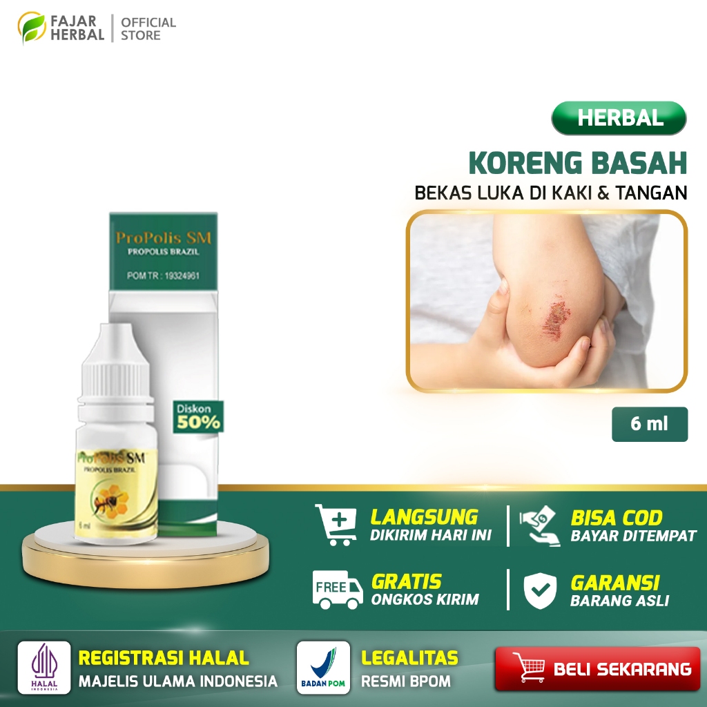 Obat Koreng Bernanah Gatal Luka Korengan di Kulit Kaki Kepala Borok Basah
