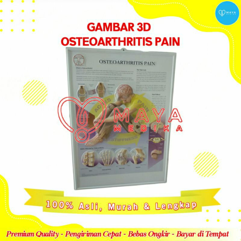 Gambar 3D Osteoarthritis Pain