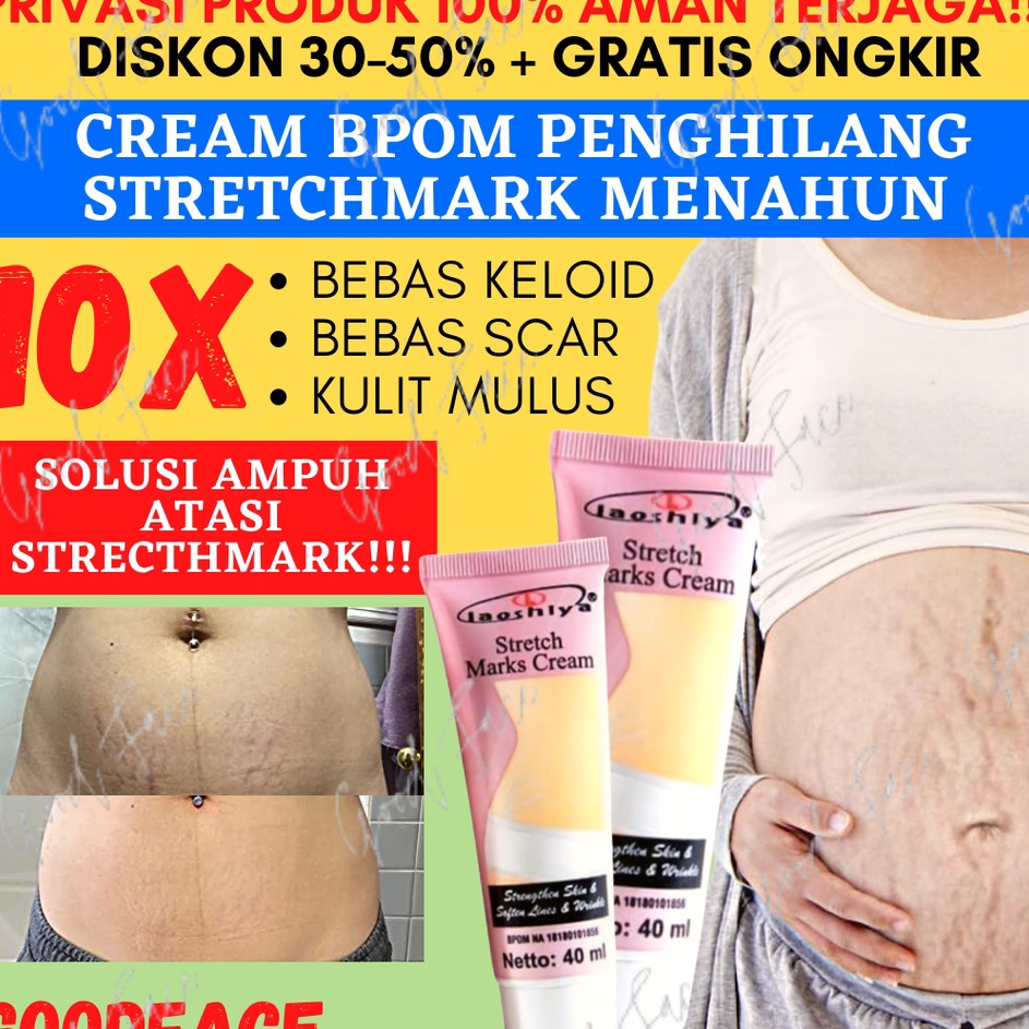LAOSHIYA STRETCH MARKS CREAM ORIGINAL  STRETCH MARKS LAOSHIYA
