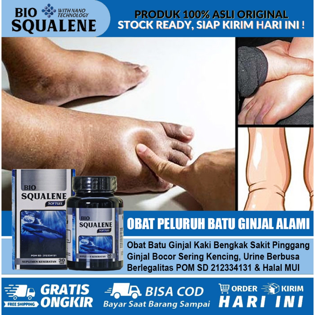 Obat Peluruuh Batu Ginjal Obat Batu Ginjal Kaki Bengkak Karena Ginjal  | Bio Squalene Ekstrak Minyak