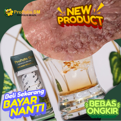 Obat Kutil di anus, Obat Kutil Di lubang Anus, Perontok Kutil Pada anus, Penghilang Kutil di anus me