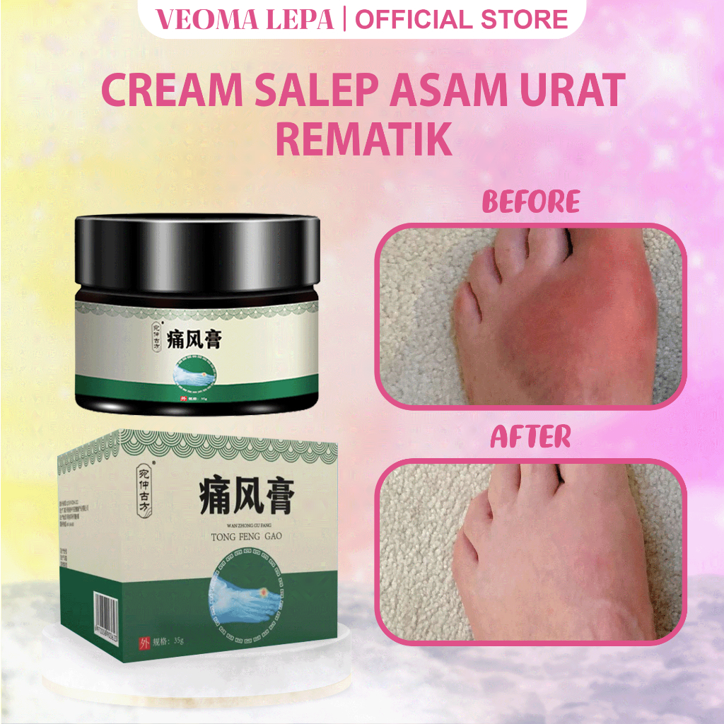 Cream Herbal Obat Asam Urat Paling Ampuh Obat Asam Urat Cina 35g