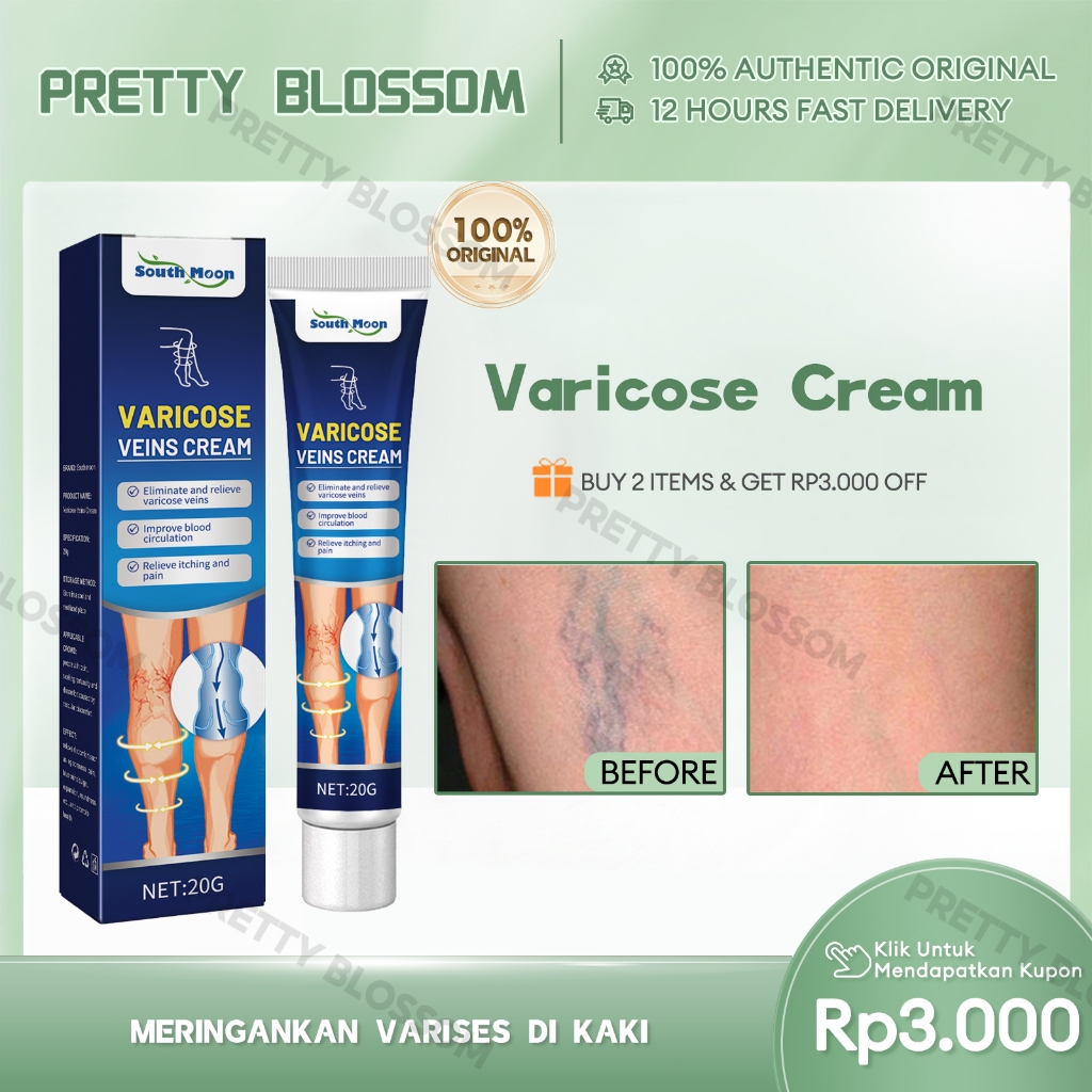 South Moon Varicose Veins Cream 20g Salep Untuk Varises Varicose Veins Obat Perawatan Varises