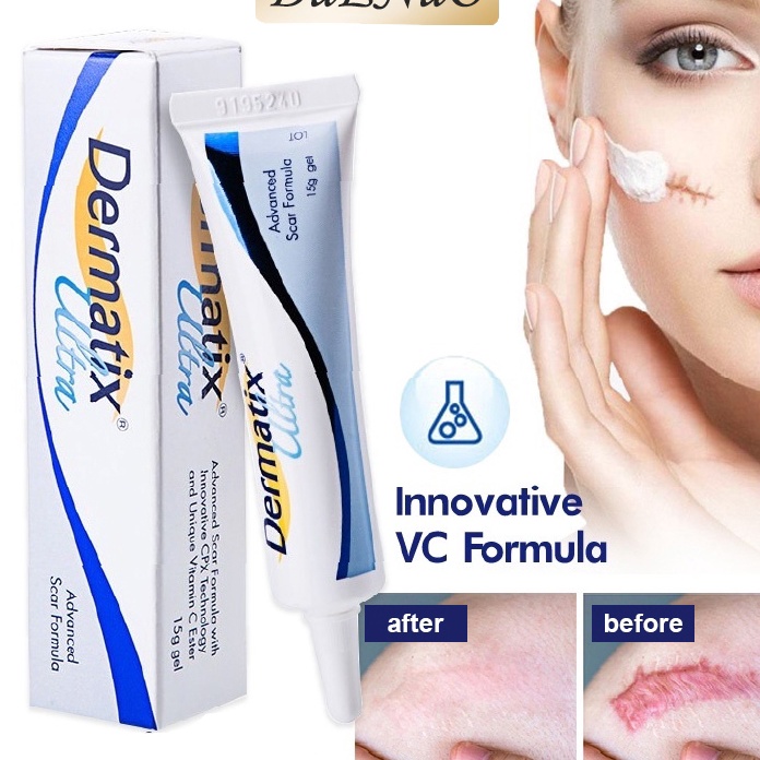 berkualitas DUENUO Dermatix Penghilang Bekas Luka Dermovate Cream Hand Penghilang Bekas Koreng Ultra