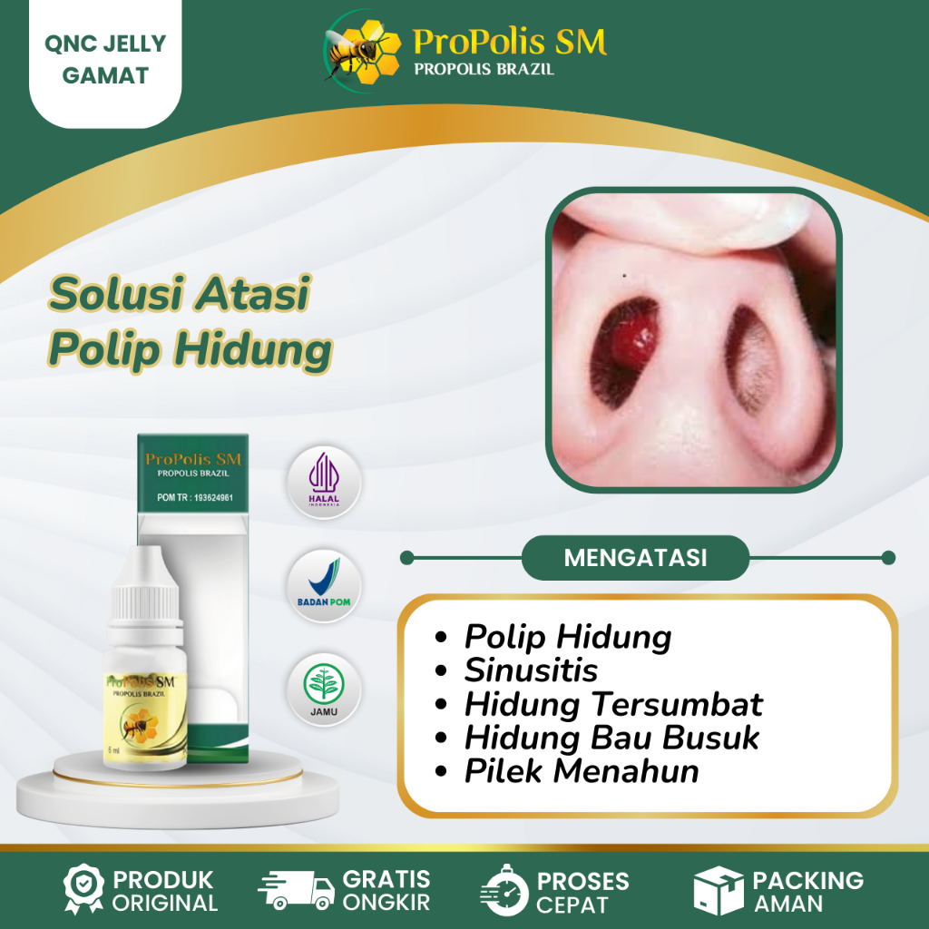 Obat Polip Hidung, Sinusitis, Pilek Kronis, Hidung Bau Busuk, Pilek Menahun, Hidung Tersumbat, Sinus