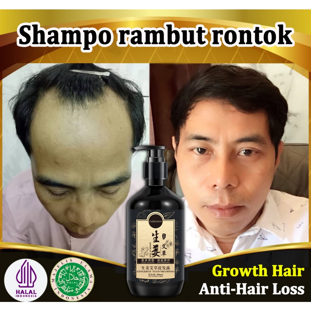Sampo Penghitam Rambut Uban Shampoo Uban Permanen Halal Ekstrak Herbal Alami Mencegah Rambut Rontok,
