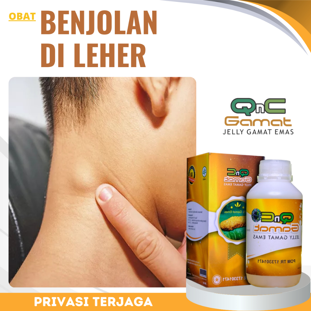 Obat Benjolan Di Leher, Obat Kelanjar Getah Bening, Obat Penghancur Benjolan, Obat Kanker, Obat Kist