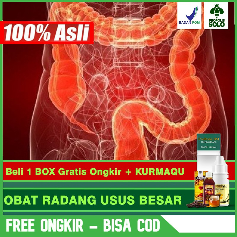 

Obat Radang Usus Besar, Masalah Pada Usus Besar Alami Propolis SM Brazil Di SOLO Bisa COD