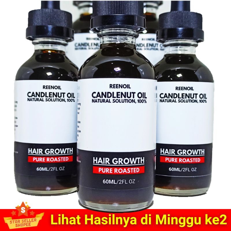 Minyak Kemiri Bakar Reenoil Murni Alami Penumbuh Rambut Rontok, Brewok, Kumis, Alis
