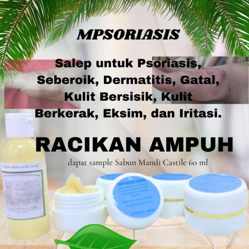 Salep cream untuk eksim psoriasis ampuh tanpa steroid - Racikan Dokter Kulit 15 gram
