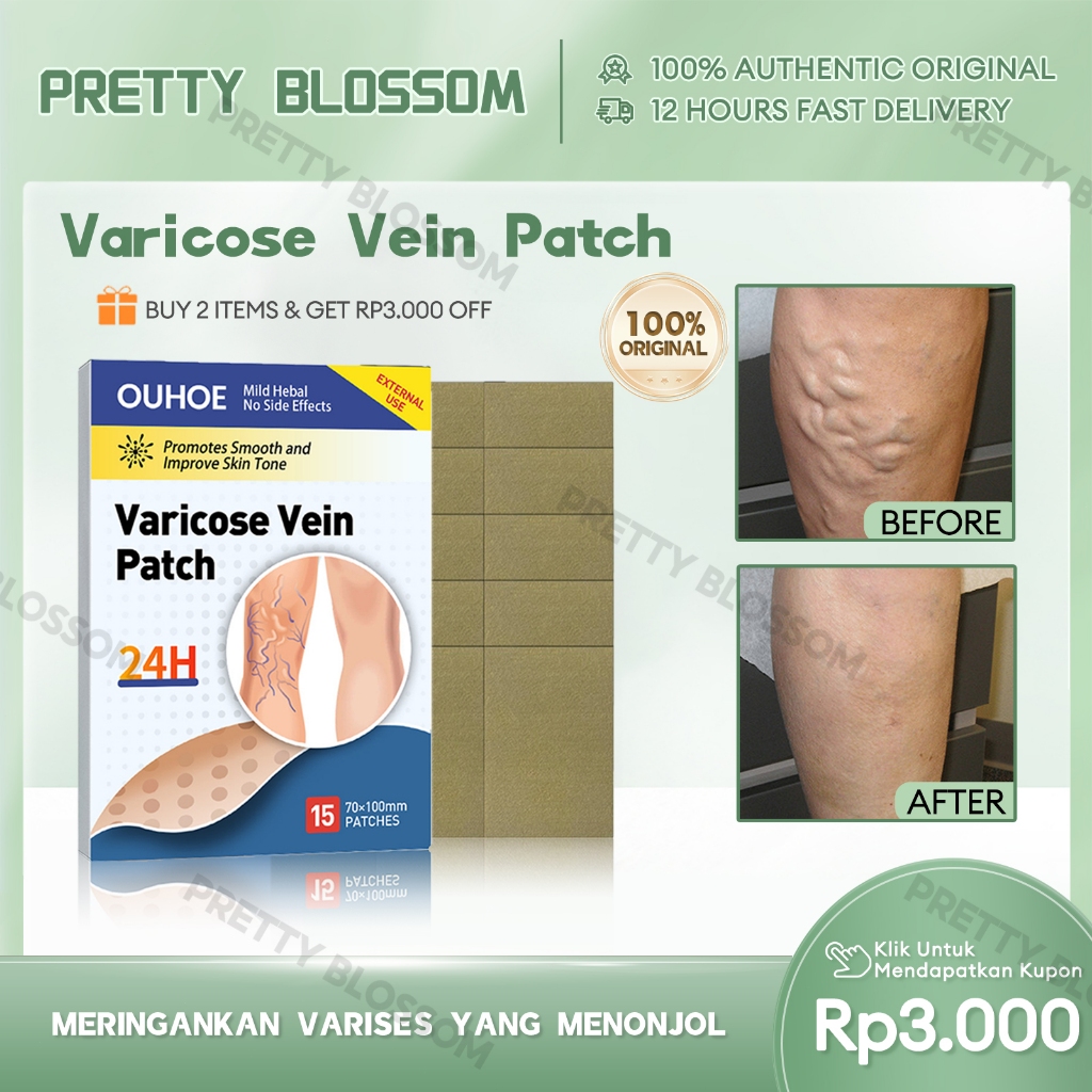 OUHOE Varicose Vein Patch 15pcs Obat Varises Koyo Varises Obat penghilang Varises Patch
