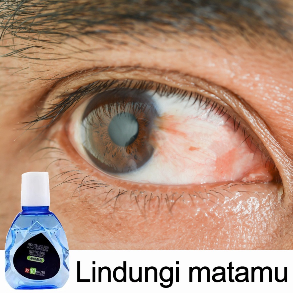 Obat mata obat mata katarak obat tetes mata 15g Mata kering Sakit eye drop Mengandung ekstrak bluebe