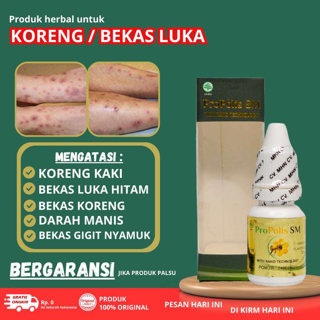 Obat Penghilang Koreng di Kaki - Penghilang bekas Luka di kaki - Obat Korengan gatal di kaki