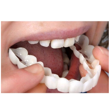 ✅COD✨ SMILE GIGI PALSU ATAS BAWAH GIGI PALSU LEPAS PASANG VENEER snap on smile
