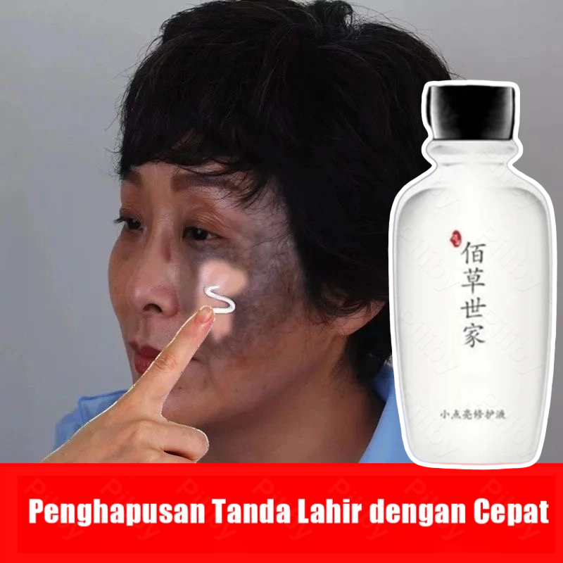 Memudarkan Tanda Lahir Obat Penghilang Tanda Lahir Coklat, Merah, Hitam Hemangioma Tanda Lahir Merah