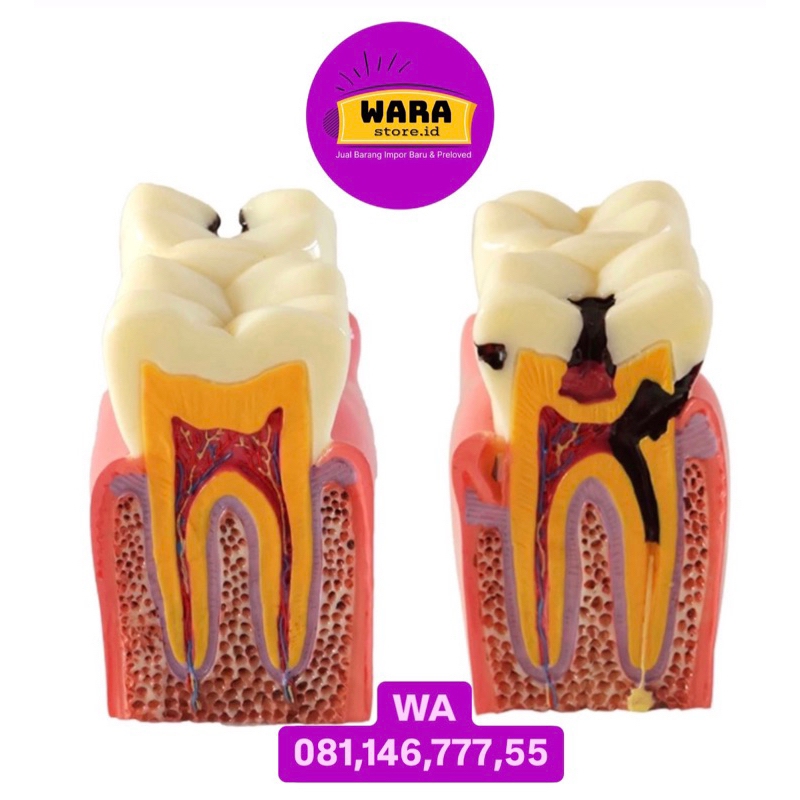 Dental study karies model gigi phantom replika tiruan edukasi kedokteran anatomi typodont model kons