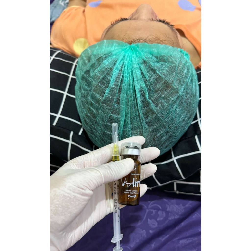 Treatment Meso Fullface & DoubleChin 10ml - Homecare TGRNG, JKT, DPK & BKS