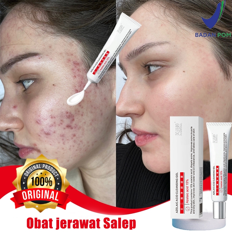 Penghilang jerawat obat jerawat dan bekas jerawat penghilang bekas jerawat 15g Obat jerawat Salep pa