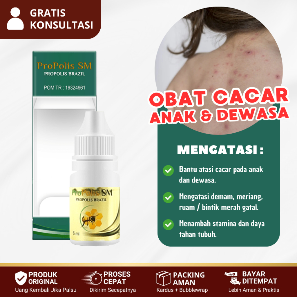 Obat Cacar Anak Dan Dewasa, Cacar Air / Api, Cacar Monyet, Cacar Ular, Cacar Singapura - Propolis SM