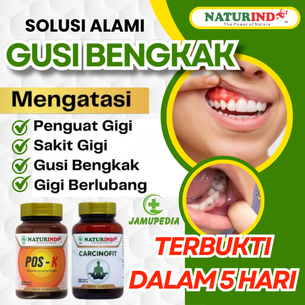 Obat Gusi Bengkak Paling Ampuh Sakit Gigi Berlubang Radang Gusi Naturindo