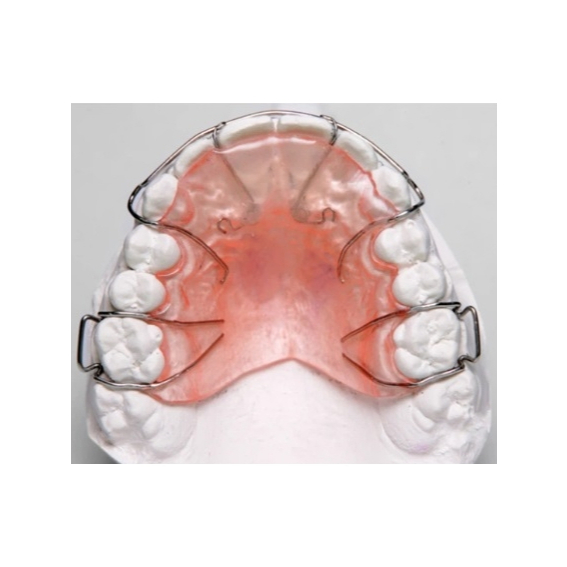RETAINER GIGI - HAWLEY RETAINER -ORTHODONTI LEPASAN - KAWAT GIGI