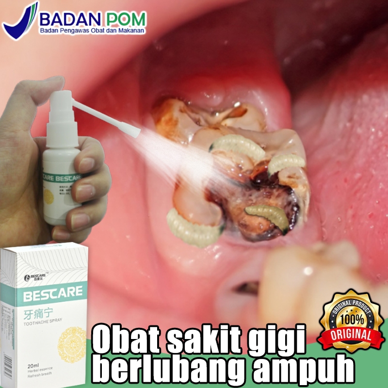 Obat sakit gigi berlubang ampuh Obat sakit gigi paling ampuh obat sakit gigi ampuh Obat gigi berluba