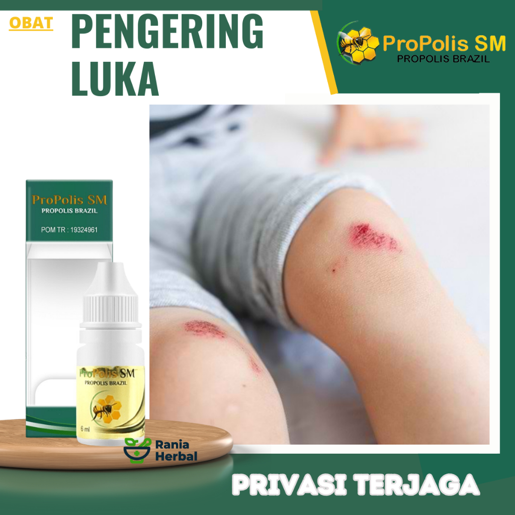 Obat Pengering Luka Basah, Obat Pengering Luka Bernanah, Obat Luka Basah Luka Kering, Obat Luka Diab