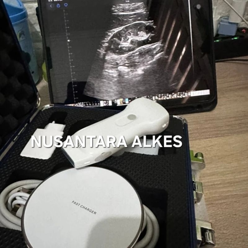 USG WIRELESS / USG WIFI/ MY USG TERBARU 3 IN 1 ECHO MURAH